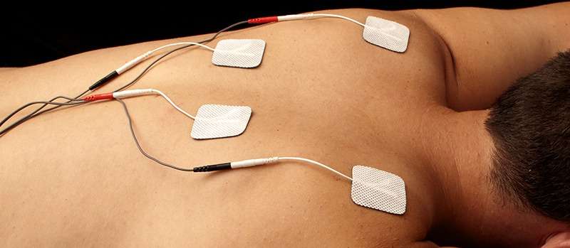 Electric Muscle Stimulation (ESTIM) in Chiropractic Care