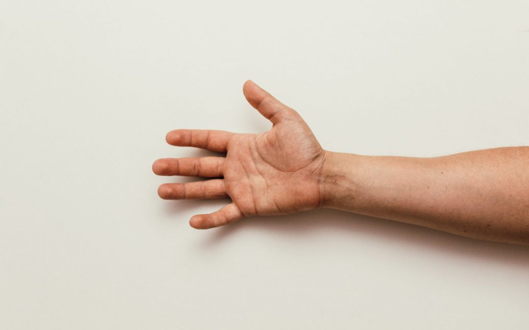 Carpal Tunnel Syndrome: How Chiropractors Can Help